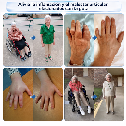 ✨✨𝗜𝑭𝑴𝑨𝑮𝑰𝐶® 𝑨𝒍𝒑𝒊𝒏𝒆 𝑩𝒐𝒕𝒂𝒏𝒊𝒄𝒂𝒍 𝑷𝒂𝒓𝒄𝒉𝒆 𝑫𝒆 𝑴𝒊𝒄𝒓𝒐𝒂𝒈𝒖𝒋𝒂𝒔 𝑷𝒂𝒓𝒂 𝑨𝒓𝒕𝒊𝒄𝒖𝒍𝒂𝒄𝒊𝒐𝒏𝒆𝒔💎