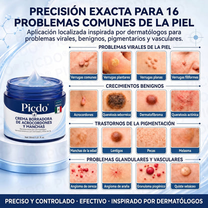🎁🎁𝐏𝐢𝐜𝐝𝐨® 𝑪𝒓𝒆𝒎𝒂 𝑩𝒐𝒓𝒓𝒂𝒅𝒐𝒓𝒂 𝒅𝒆 𝑨𝒄𝒓𝒐𝒄𝒐𝒓𝒅𝒐𝒏𝒆𝒔 𝒚 𝑴𝒂𝒏𝒄𝒉𝒂𝒔 𝒆𝒏 7 𝑫í𝒂𝒔🩵 (𝐹ó𝑟𝑚𝑢𝑙𝑎 𝑠𝑖𝑛 𝑑𝑜𝑙𝑜𝑟 𝑛𝑖 𝑐𝑖𝑐𝑎𝑡𝑟𝑖𝑐𝑒𝑠) 💪