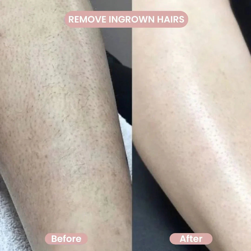 Tryviralnow  – 2-in-1 Bikini & Body Trimmer