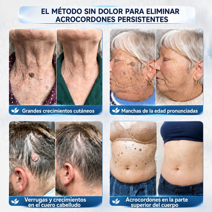 🎁🎁𝐏𝐢𝐜𝐝𝐨® 𝑪𝒓𝒆𝒎𝒂 𝑩𝒐𝒓𝒓𝒂𝒅𝒐𝒓𝒂 𝒅𝒆 𝑨𝒄𝒓𝒐𝒄𝒐𝒓𝒅𝒐𝒏𝒆𝒔 𝒚 𝑴𝒂𝒏𝒄𝒉𝒂𝒔 𝒆𝒏 7 𝑫í𝒂𝒔🩵 (𝐹ó𝑟𝑚𝑢𝑙𝑎 𝑠𝑖𝑛 𝑑𝑜𝑙𝑜𝑟 𝑛𝑖 𝑐𝑖𝑐𝑎𝑡𝑟𝑖𝑐𝑒𝑠) 💪